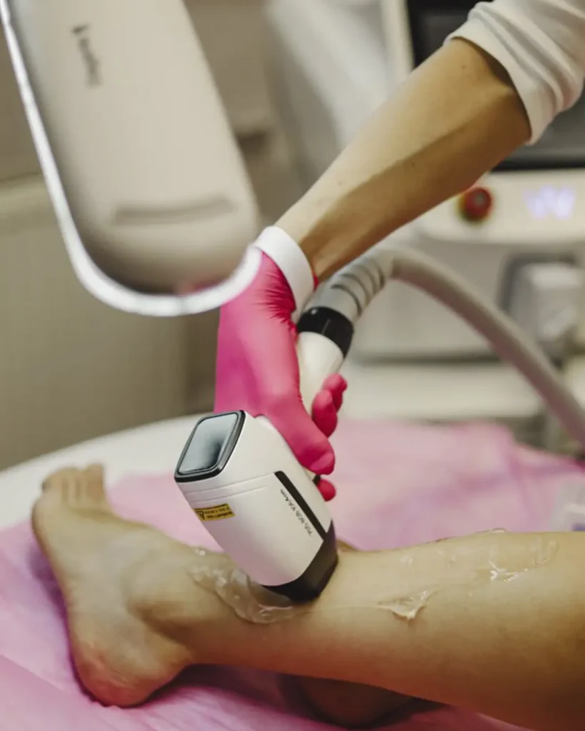 curso de depilacion laser con practicas